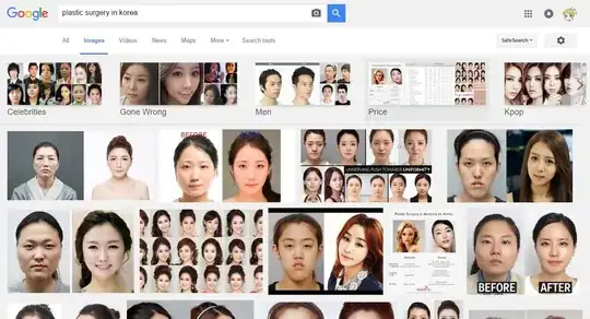 plastic surgery in Korea