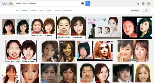 plastic surgery in Japan