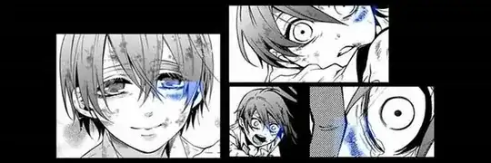 Ciel's bruise under the eye