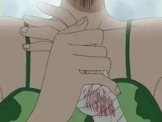 Bandages on Nami's left hand.