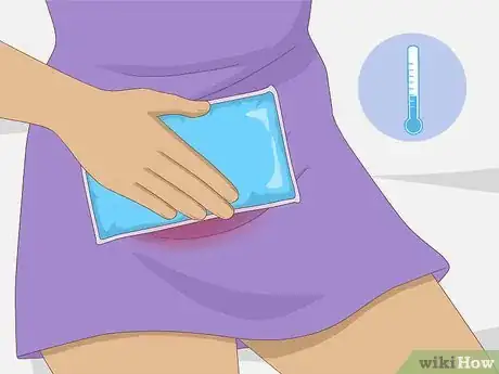 Image titled Get Rid of a Yeast Infection at Home Step 10