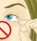 Remove Something from Your Eye