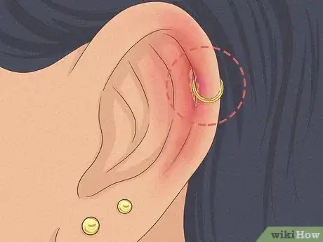 Image titled Is It Safe to Pierce Your Own Cartilage Step 24