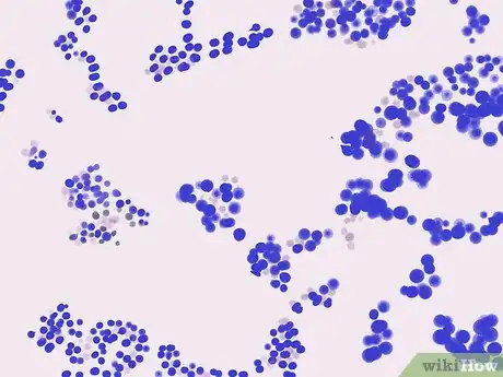 Image titled Gram Stain Step 15