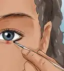 Get Rid Of a Stye