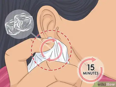 Image titled Put Your Earring Back when It Won't Go in Step 4