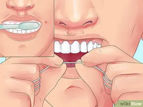 Image titled Whiten Your Teeth Without Spending a Lot of Money Step 22