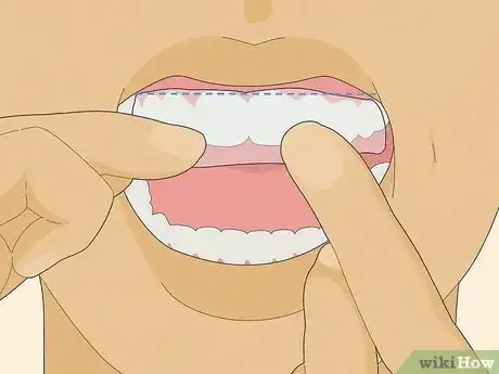 Image titled Apply Crest 3D White Strips Step 3