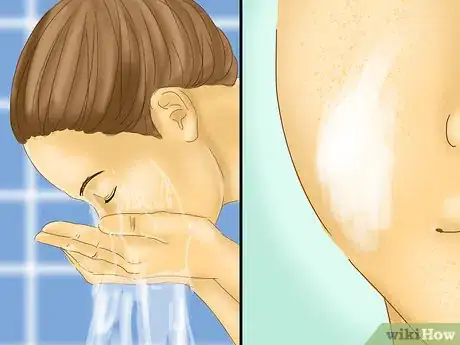 Image titled Get Rid of Rosy Cheeks Step 1