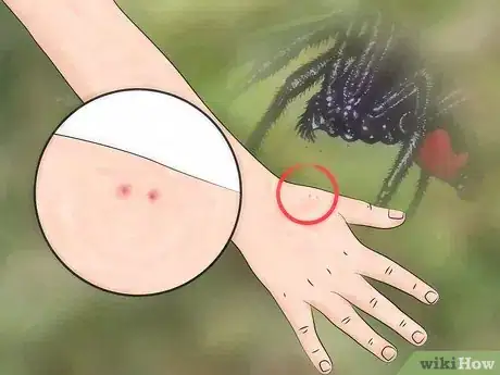 Image titled Identify a Spider Bite Step 1