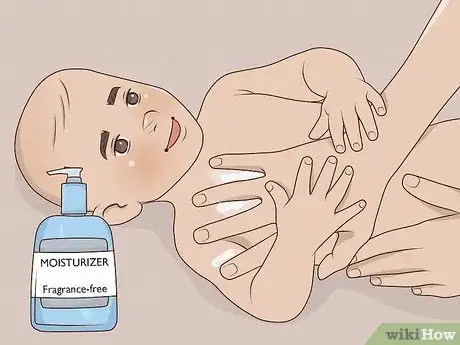 Image titled Treat Infant Eczema Naturally Step 3