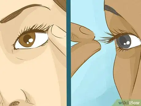 Image titled Get an Eyelash Out of Your Eye Step 7