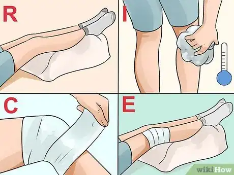 Image titled Get Rid of a Cyst Step 5