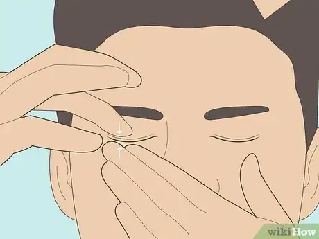 Image titled Remove Contact Lenses Step 10