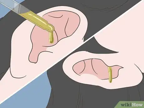 Image titled Unclog Your Ears After a Cold Step 8