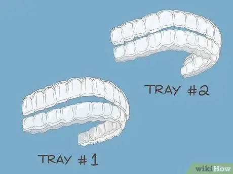 Image titled Put Invisalign Back in if You Haven't Worn Them for a Long Time Step 6