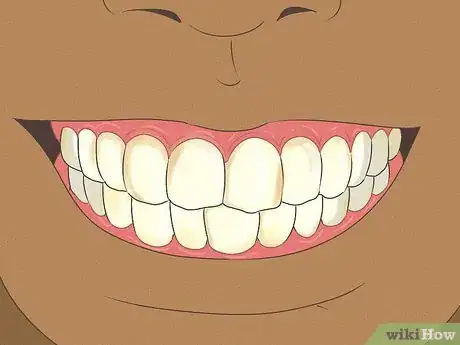 Image titled Fix Nicotine Stained Teeth Step 11