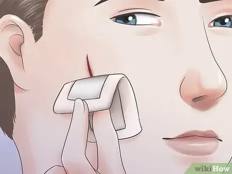 Image titled Get Rid of a Cut on Your Face Step 17