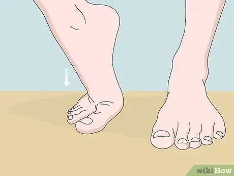 Image titled Crack Your Toe Step 9