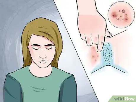 Image titled Recognize Genital Warts Step 1