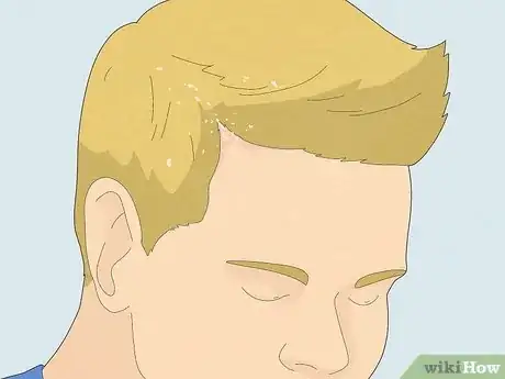 Image titled Make Your Scalp Stop Itching Step 12