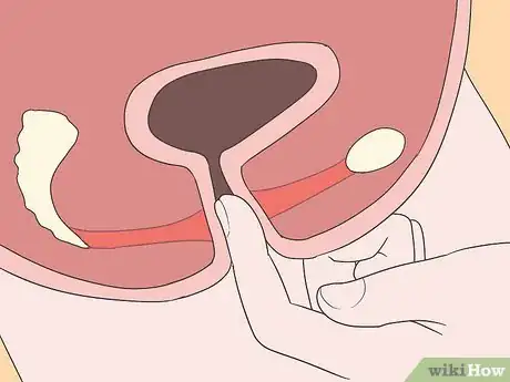 Image titled Strengthen Vaginal Muscles Step 5