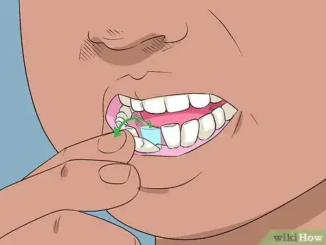 Image titled Pull out a Loose Tooth Step 1