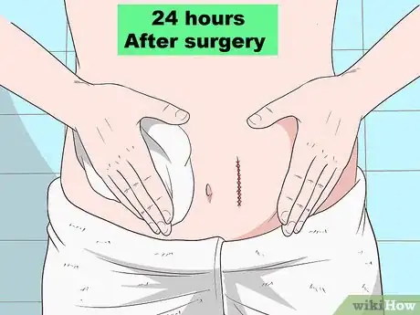 Image titled Reduce Abdominal Swelling After a Surgery Step 2