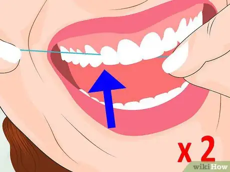 Image titled Avoid Getting Canker Sores Step 3