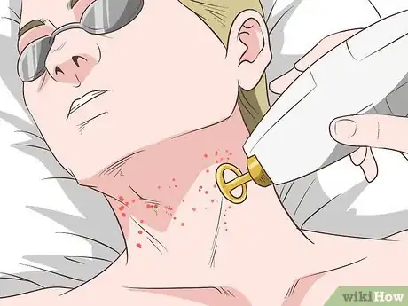 Image titled Get Rid of Neck Acne Step 23