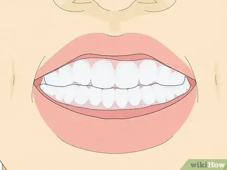 Image titled Whiten Your Teeth with Banana Peel Step 6