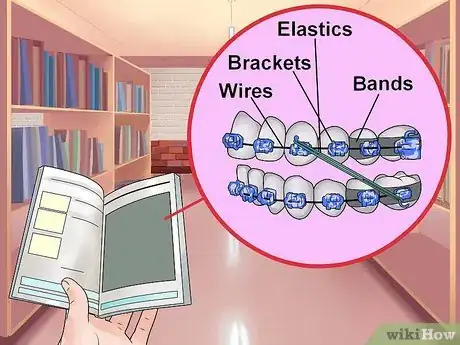 Image titled Make Braces Look Less Noticeable Step 1