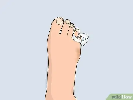 Image titled Heal a Toe Injury Step 10