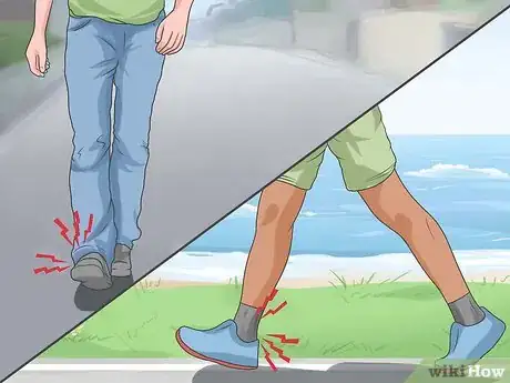 Image titled Tell if a Foot Is Broken Step 1