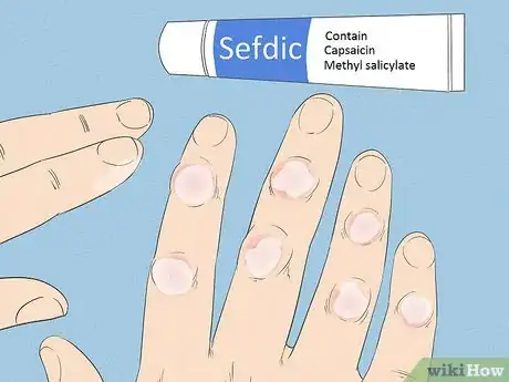 Image titled Get Rid of Arthritis Bumps on Fingers Step 4