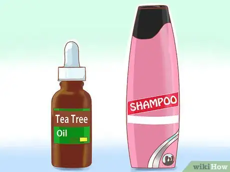 Image titled Get Rid of Dandruff (Natural Methods) Step 1