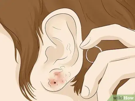 Image titled Keep a Piercing from Rejecting Step 13.jpeg