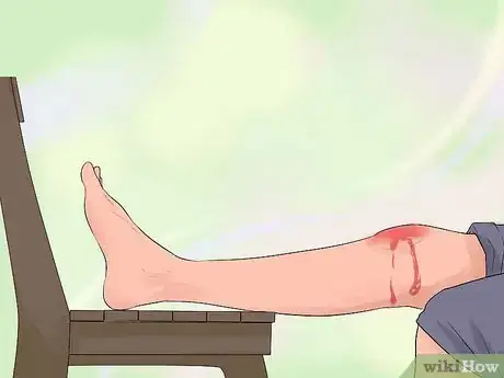 Image titled Treat Severe Bleeding During First Aid Step 7