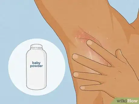 Image titled Heal Armpit Rash Step 13