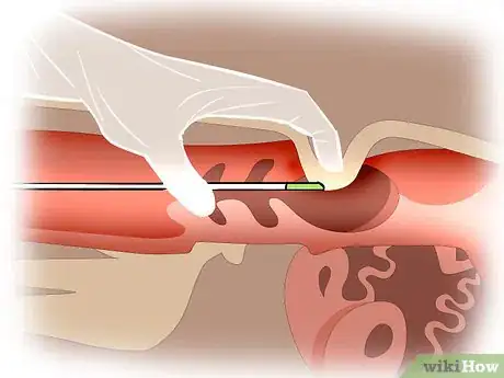 Image titled Artificially Inseminate Cows and Heifers Step 20