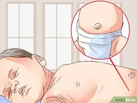 Image titled Diagnose a Child's Hernia Step 1