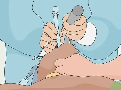 Image titled Administer General Anesthesia Step 6