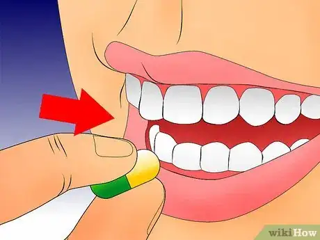 Image titled Get Rid of Gingivitis Step 8