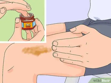 Image titled Use Tiger Balm Step 2