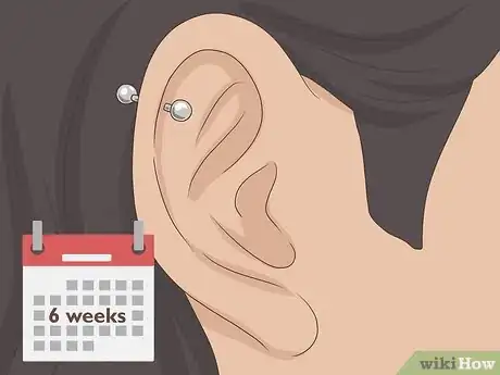 Image titled Treat an Ear Piercing Infection Bump Step 10