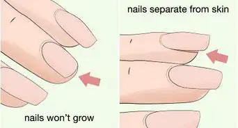 Strengthen Weak Fingernails Naturally