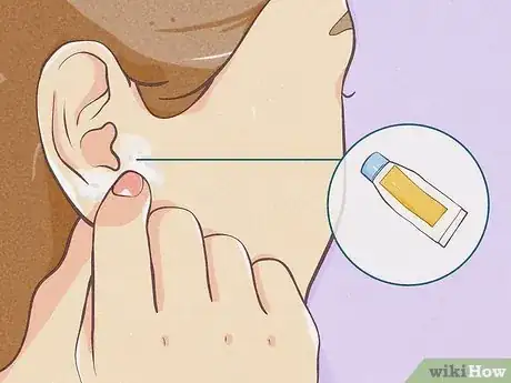 Image titled Gauge Your Ears Step 12