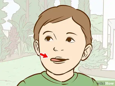 Image titled Fix a Toddler's Chapped Lips Step 4