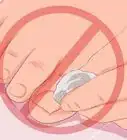 Remove Infection from an Ingrown Toenail