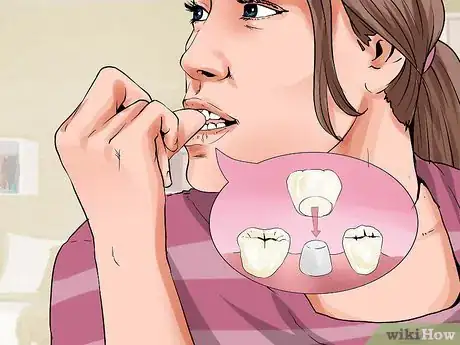 Image titled Avoid Dental Crown Problems Step 2